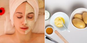 Cách trị nám bằng khoai tây đang được nhiều người áp dụng tại nhà