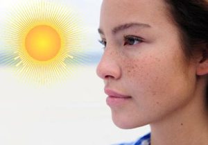 Ánh nắng mặt trời là một trong những yếu tố kích thích nám trở nên rõ ràng hơn